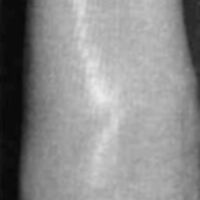 http://www.oandplibrary.org/cpo/images/1985_04_031/1985_04_031-02.jpg