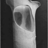 http://www.oandplibrary.org/cpo/images/1984_01_006/1984_01_006-5.jpg