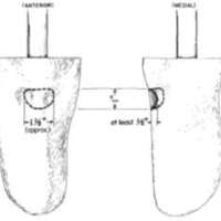 http://www.oandplibrary.org/al/images/1962_02_025/tmp62D-05.jpg