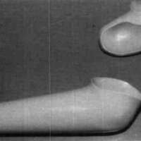 http://www.oandplibrary.org/cpo/images/1985_04_031/1985_04_031-08.jpg