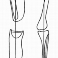 http://www.oandplibrary.org/cpo/images/1988_02_081/1988_02_081-07.jpg