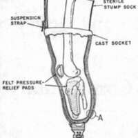 http://www.oandplibrary.org/cpo/images/1978_04_001/1978_04_001-1.jpg