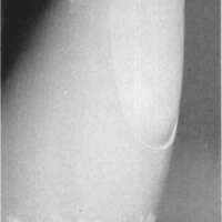 http://www.oandplibrary.org/cpo/images/1984_01_006/1984_01_006-2.jpg