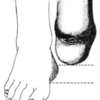 http://www.oandplibrary.org/al/images/1961_01_004/a013.jpg