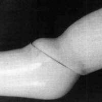 http://www.oandplibrary.org/cpo/images/1987_03_131/1987_03_131-05.jpg