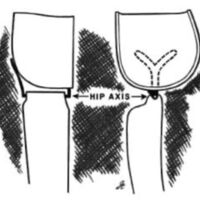 http://www.oandplibrary.org/al/images/1957_02_022/aut57b-005.jpg