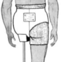 http://www.oandplibrary.org/al/images/1957_02_039/sp66d-006.jpg