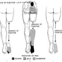 http://www.oandplibrary.org/al/images/1955_01_004/1955-JanuaryOCRBatchc-06.jpg