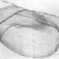 http://www.oandplibrary.org/al/images/1957_02_039/sp66d-002.jpg