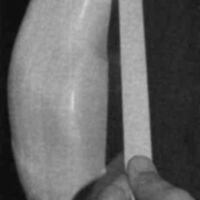 http://www.oandplibrary.org/cpo/images/1985_04_031/1985_04_031-03.jpg
