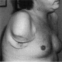 http://www.oandplibrary.org/cpo/images/1987_01_045/1987_01-045-05.jpg