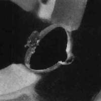 http://www.oandplibrary.org/cpo/images/1987_01_045/1987_01-045-07.jpg