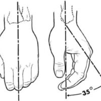 http://www.oandplibrary.org/al/images/1955_02_022/1955-MayOCRBatch-27.jpg