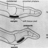 http://www.oandplibrary.org/cpo/images/1988_02_051/1988_02_051-2.jpg