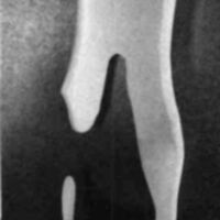 http://www.oandplibrary.org/cpo/images/1986_01_015/1986_01_015-01.jpg