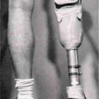 http://www.oandplibrary.org/al/images/1962_02_074/tmp62F-4.jpg