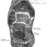 http://www.oandplibrary.org/al/images/1961_01_004/a018.jpg