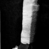 http://www.oandplibrary.org/al/images/1967_02_028/aut67-12.jpg