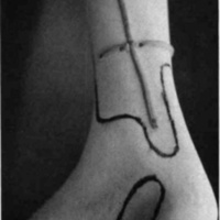 http://www.oandplibrary.org/cpo/images/1986_01_015/1986_01_015-15.jpg