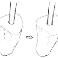 http://www.oandplibrary.org/al/images/1962_02_025/tmp62D-07.jpg