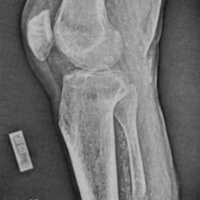 http://www.oandplibrary.org/cpo/images/1987_03_118/1987_03_118-06.jpg