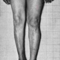 http://www.oandplibrary.org/al/images/1970_01_001/1970_01_001-10.jpg