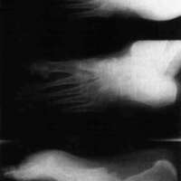 http://www.oandplibrary.org/cpo/images/1988_02_061/1988_02_061-1.jpg