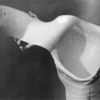 http://www.oandplibrary.org/cpo/images/1988_03_119/1988_03_119-5.jpg