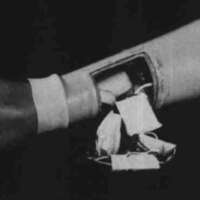 http://www.oandplibrary.org/cpo/images/1981_03_007/1981_03_007-2.jpg