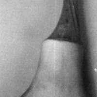 http://www.oandplibrary.org/cpo/images/1988_01_024/1988_01_024-2.jpg