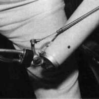 http://www.oandplibrary.org/cpo/images/1983_03_008/1983_03_008-2.jpg