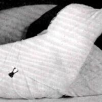 http://www.oandplibrary.org/al/images/1967_01_001/1967_01_001-11.jpg