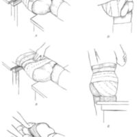http://www.oandplibrary.org/al/images/1957_02_039/sp66d-004.jpg