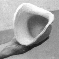 http://www.oandplibrary.org/cpo/images/1987_03_118/1987_03_118-05.jpg