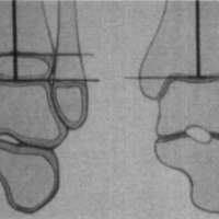 http://www.oandplibrary.org/cpo/images/1986_01_008/1986_01_008-05.jpg