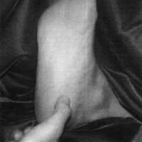 http://www.oandplibrary.org/cpo/images/1988_02_044/1988_02_044-2.jpg