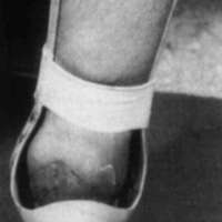 http://www.oandplibrary.org/cpo/images/1988_01_014/1988_01_014-2.jpg