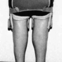 http://www.oandplibrary.org/cpo/images/1984_04_026/1984_04_026-2.jpg
