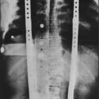 http://www.oandplibrary.org/cpo/images/1981_01_001/1981_01_001-5.jpg