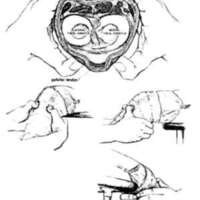 http://www.oandplibrary.org/al/images/1962_02_025/tmp62D-03.jpg