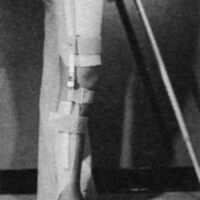 http://www.oandplibrary.org/cpo/images/1977_01_002/1977_01_002-3.jpg