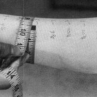 http://www.oandplibrary.org/cpo/images/1987_03_118/1987_03_118-09.jpg