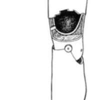http://www.oandplibrary.org/al/images/1970_02_001/tmp627-04.jpg
