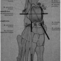 http://www.oandplibrary.org/cpo/images/1986_01_008/1986_01_008-01.jpg