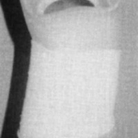 http://www.oandplibrary.org/cpo/images/1986_03_105/1986_03_105-11.jpg
