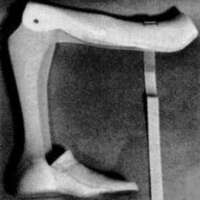http://www.oandplibrary.org/cpo/images/1977_03_005/1977_03_005-5.jpg