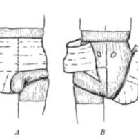 http://www.oandplibrary.org/al/images/1957_02_039/sp66d-005.jpg