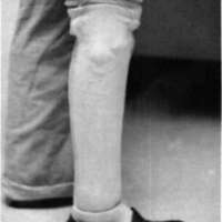 http://www.oandplibrary.org/cpo/images/1984_03_018/1984_03_018-4.jpg