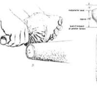http://www.oandplibrary.org/al/images/1962_02_025/tmp62D-17.jpg