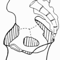 http://www.oandplibrary.org/cpo/images/1988_02_081/1988_02_081-06.jpg